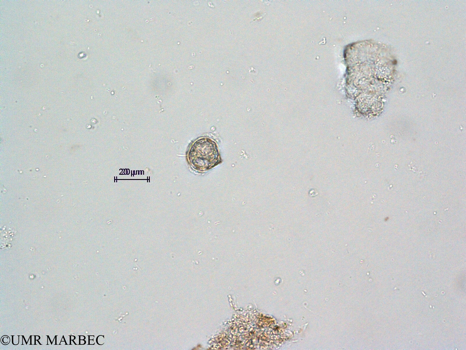 phyto/Scattered_Islands/all/COMMA April 2011/Protoperidinium steinii (ancien Protoperidinium 21 recomposé)(copy).jpg